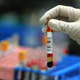 Image for article titled Good News: Natural Immunity to the Coronavirus May Last Years, Study Suggests